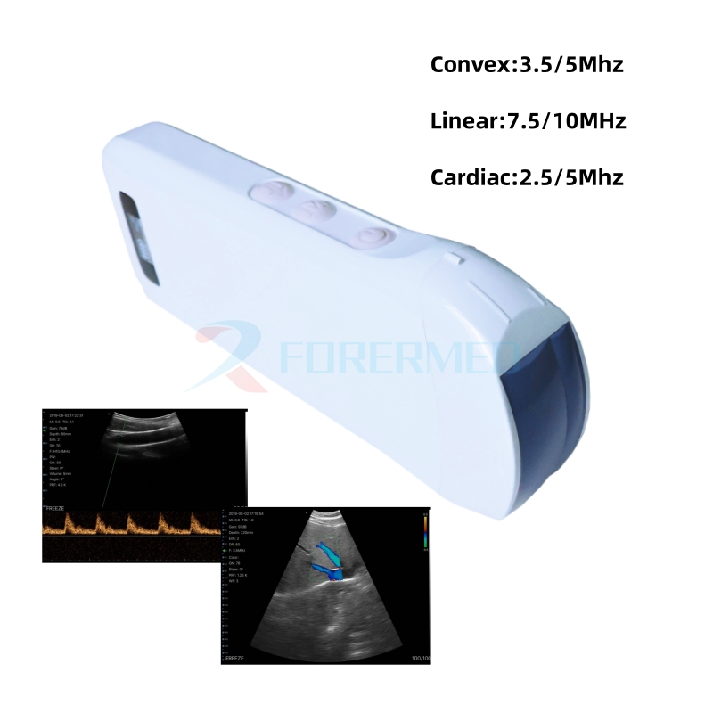 3 en 1 Escáner de ultrasonido tipo sonda cardíaca lineal covex inalámbrica
