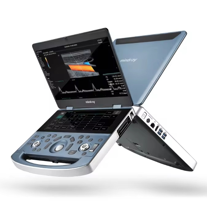 Mindray MX7 Máquina de Ultrasonido Digital de Alto Costo Efectivo 3D Máquina de Ultrasonido Doppler Color