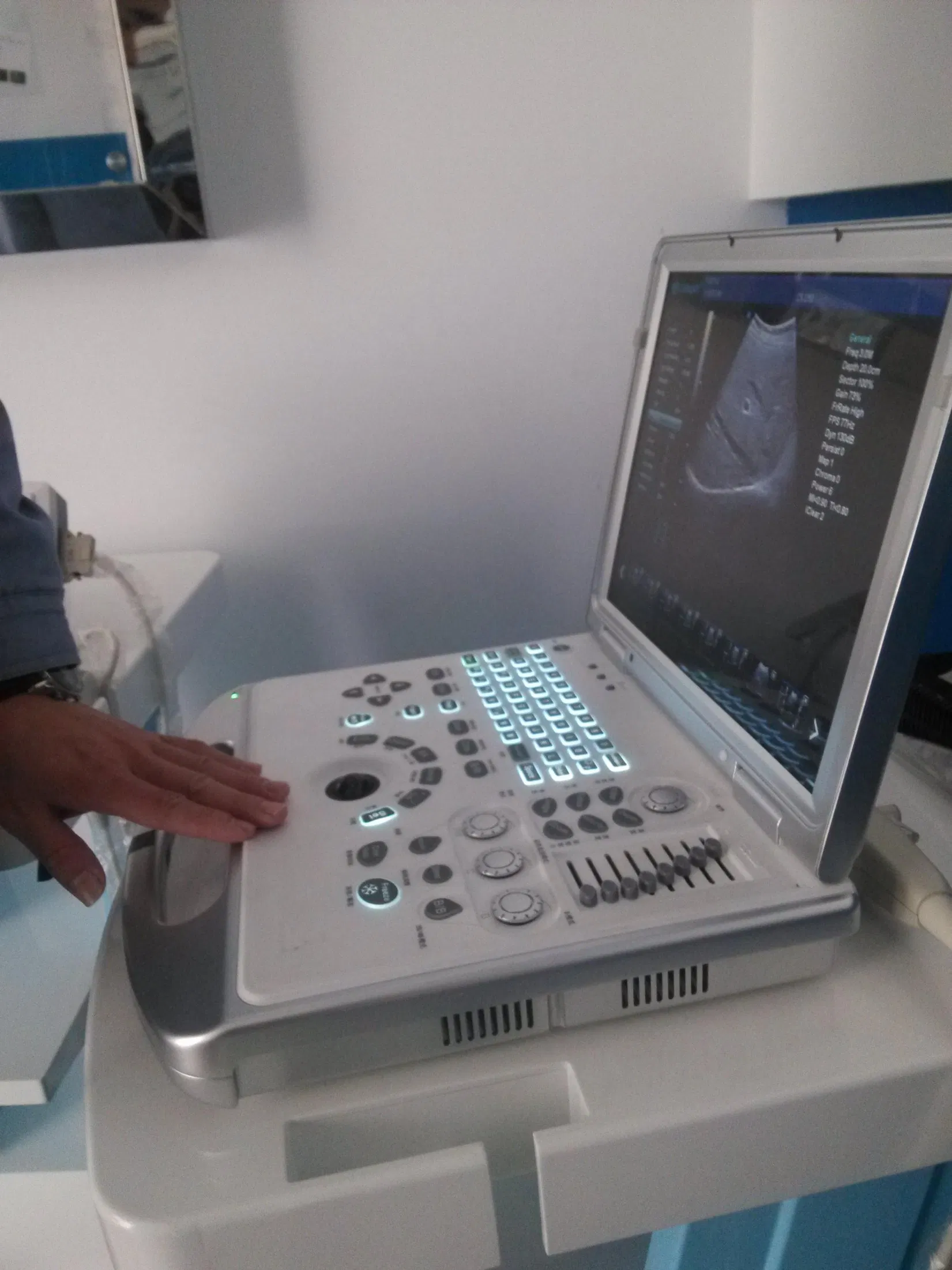 Pl-C60 Escáner de ultrasonido portátil Plus Medical, 3D Máquina de Doppler en color