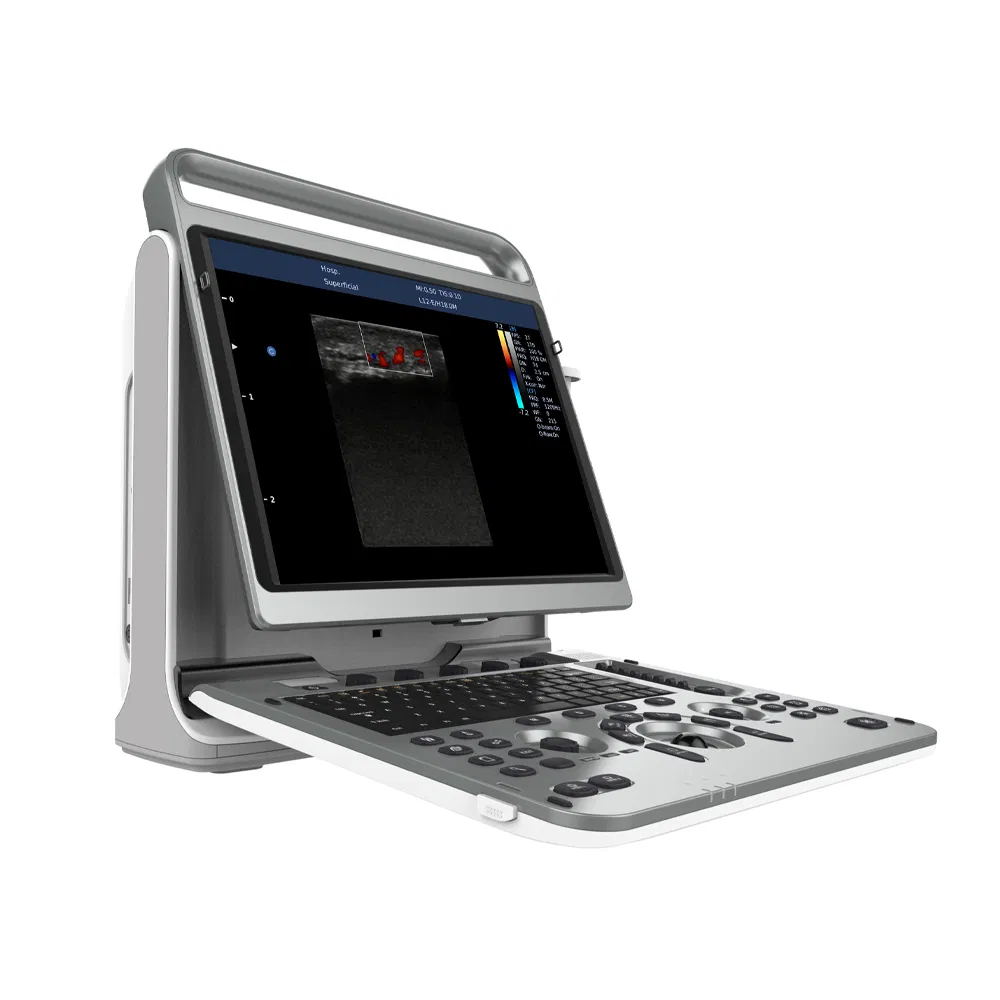 Máquina de Ultrasonido Diagnóstico Portátil Ebit50 3D 4D Sistema Doppler Color con C3-E Máquina de Diagnóstico Sistema Doppler