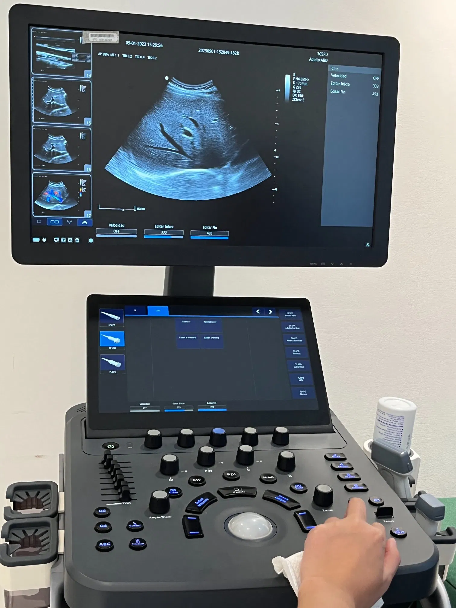 Ltub72 Carro de Alta Definición de Ciencias Médicas 3D/4D Precio del Sistema de Ultrasonido Doppler Color