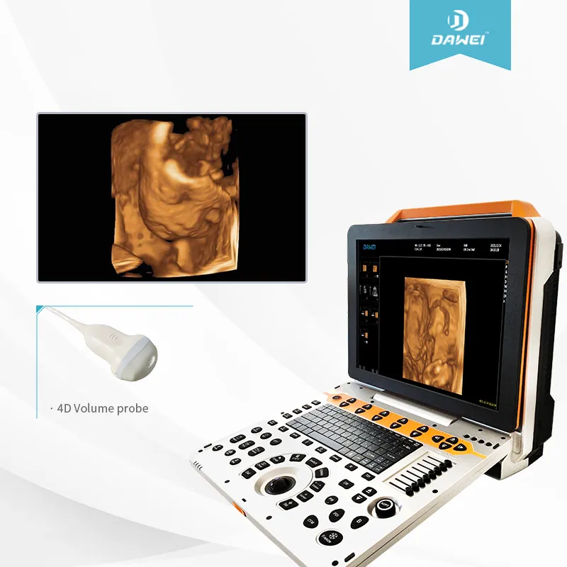 Imagen Clínica DW-P6 Abdomen
