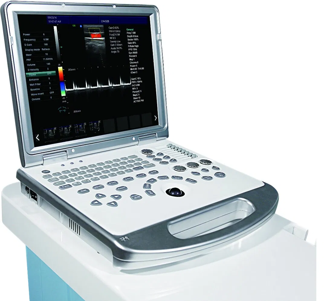 Pl-C60 Escáner de ultrasonido portátil Plus Medical, 3D Máquina de Doppler en color