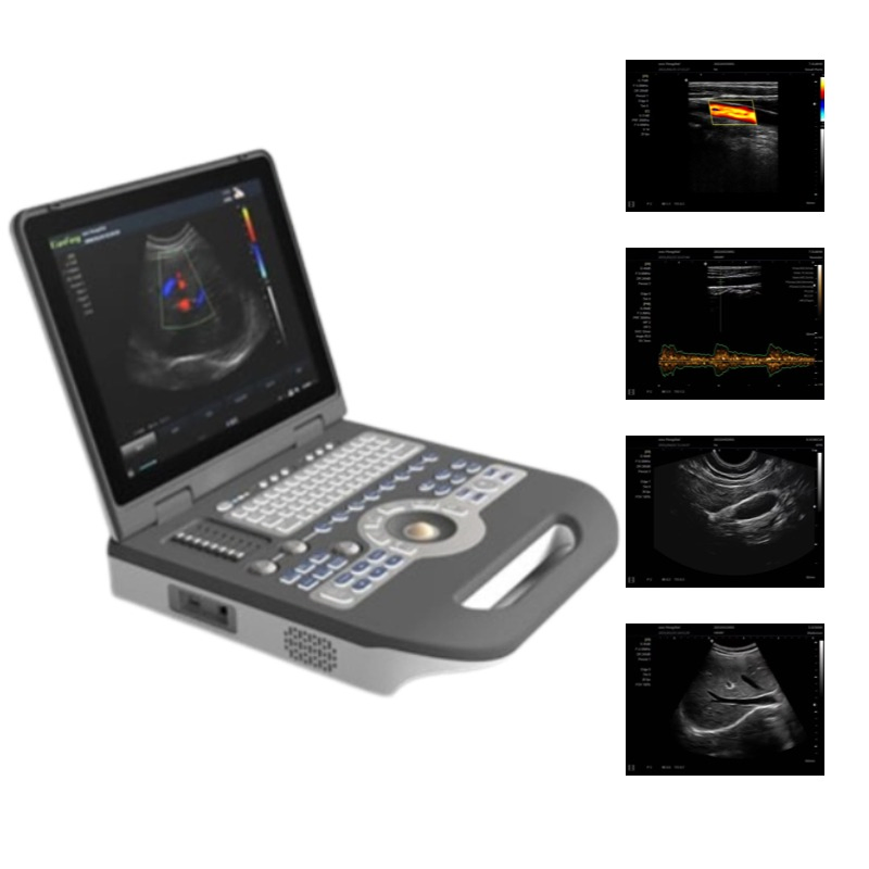 3D Escáner de ultrasonido Doppler color portátil Máquina de ultrasonido