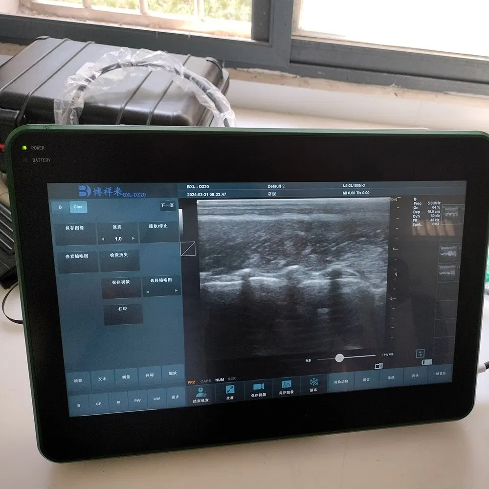 Bxl-Dz20 Sistema de Ultrasonido Doppler de Actividad Ovárica para Cerdos con Certificación CE ISO para Grasa Dorsal