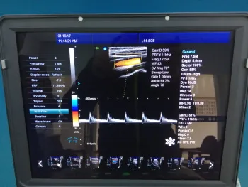 Diseño de Teclado y Pantalla del Ecógrafo