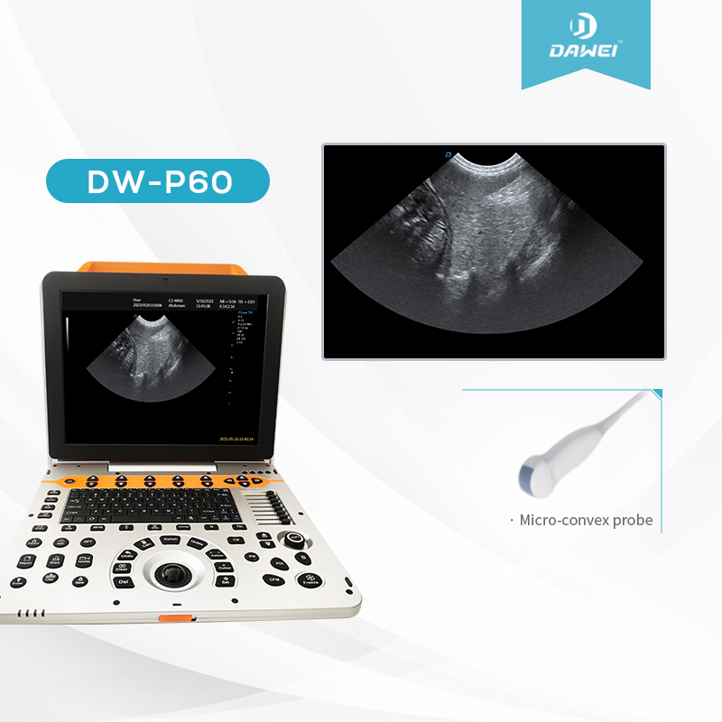 Máquinas de Imagen Portátiles Dwp6 Sistema de Ultrasonido Doppler Color Aprobado por CE