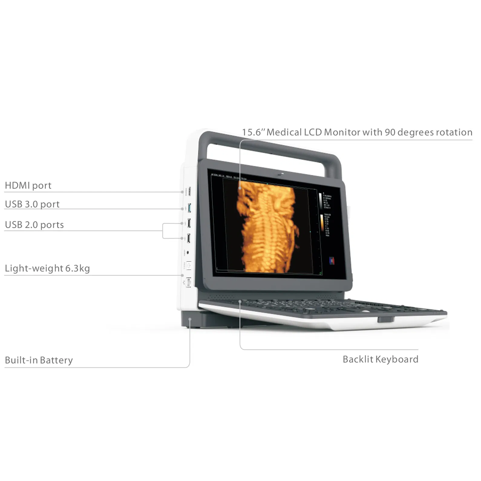 Huc-500 4D Sistema de Diagnóstico Ultrasónico Doppler Color Portátil Precio