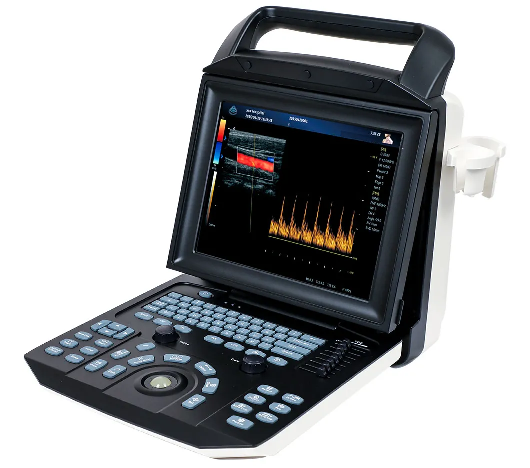 Sistema de ultrasonido cardíaco portátil con ecógrafo color Doppler para laptop