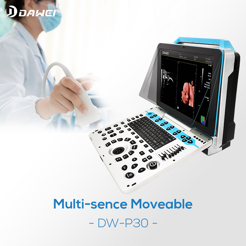 Máquina Médica de Ultrasonido Color Portable Doppler3d 4D