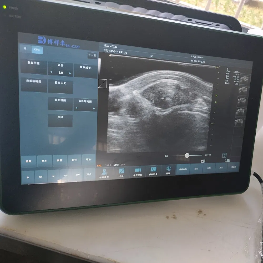 Bxl-Dz20 Sistema de Ultrasonido Doppler de Actividad Ovárica para Cerdos con Certificación CE ISO para Grasa Dorsal