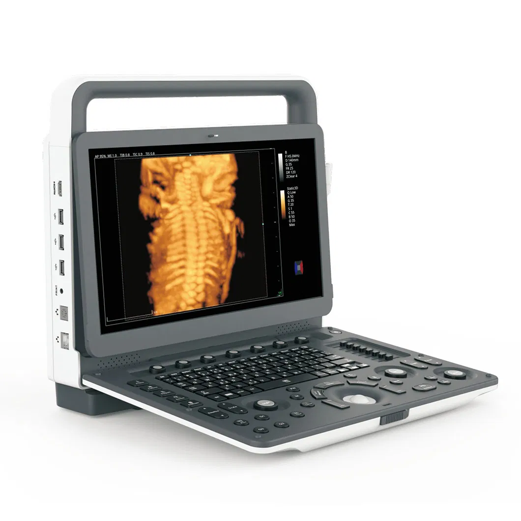 HUC-500 Doppler Color Portátil