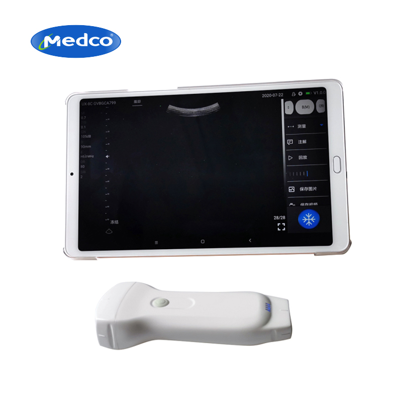 Escáner de ultrasonido Doppler color inalámbrico portátil mini de doble sonda PU80
