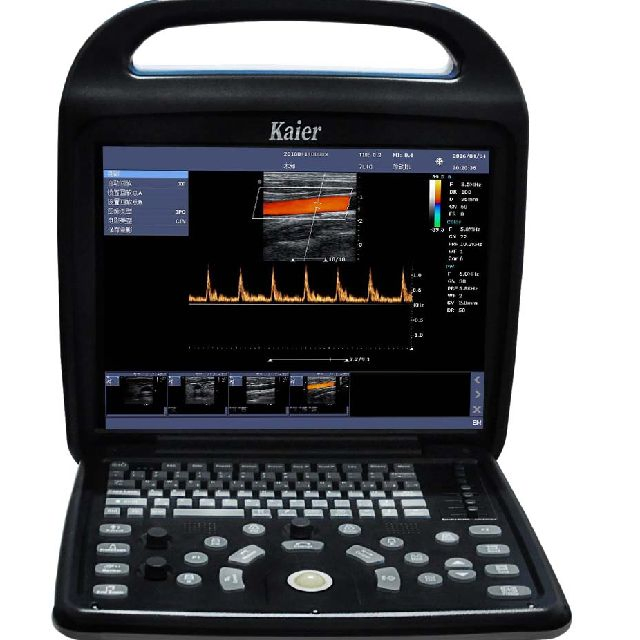 Sistema de Diagnóstico por Ultrasonido Doppler Color C80