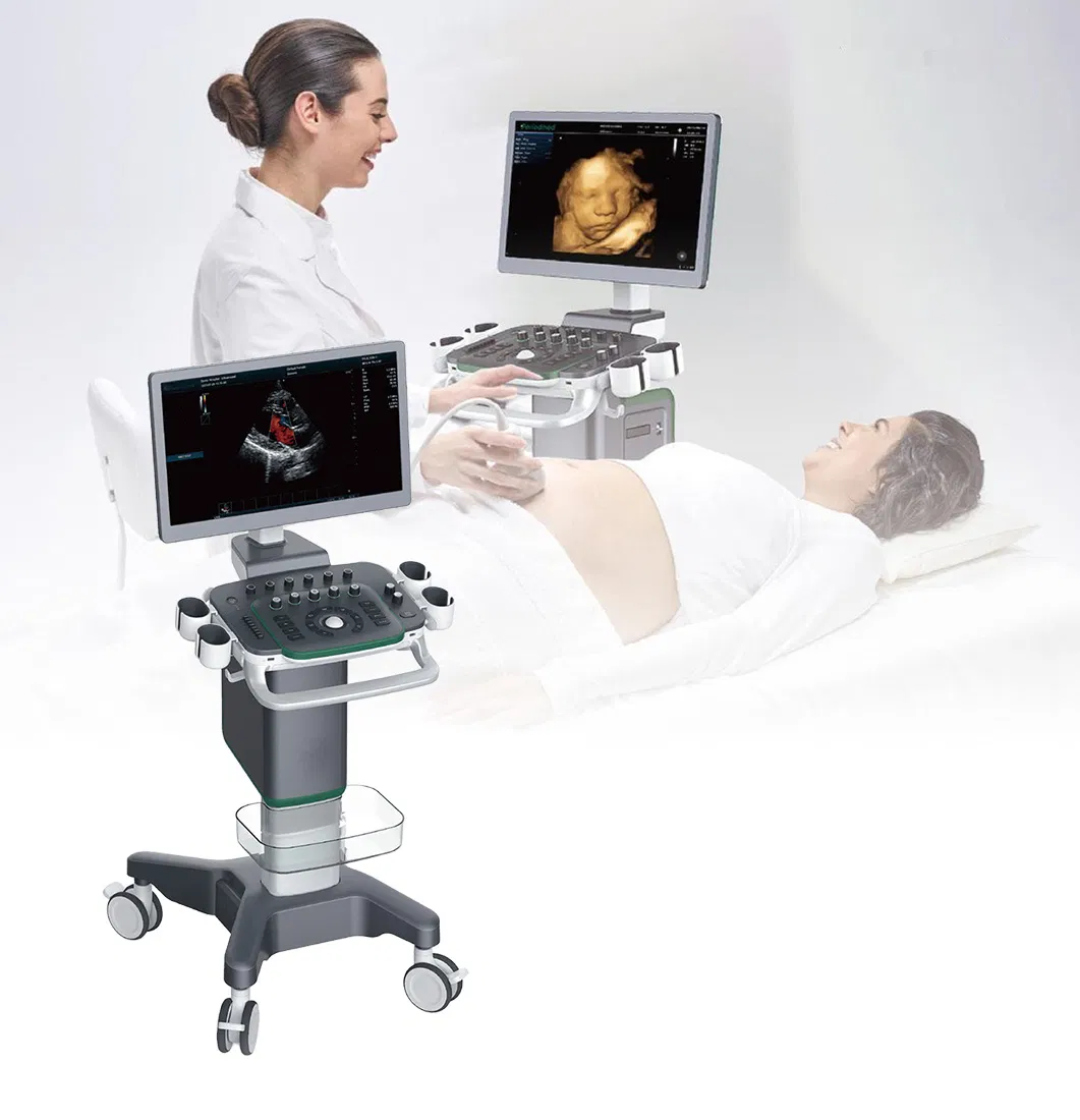 Dispositivo de Ultrasonido Médico de Imagen Digital Avanzada 4D Sistema de Diagnóstico Doppler Color Visual