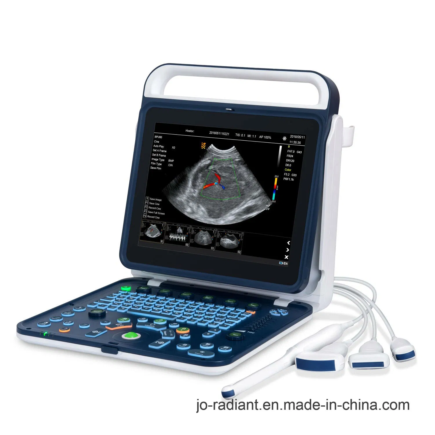 Sistema de escáner ultrasónico Doppler color portátil