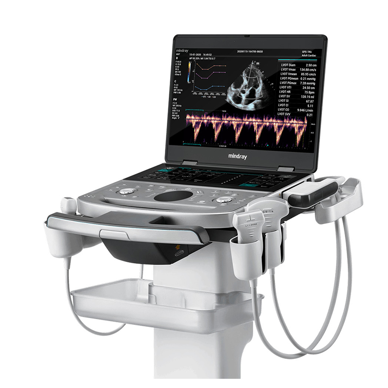 Sistema de ultrasonido médico de la serie ME de Mindray para imágenes cardíacas, abdominales y vasculares humanas