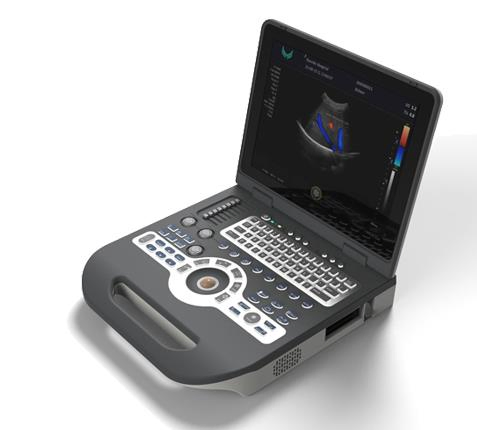 Xf3500 Portátil 4D Escáner de ultrasonido Doppler color/ Máquina de ultrasonido