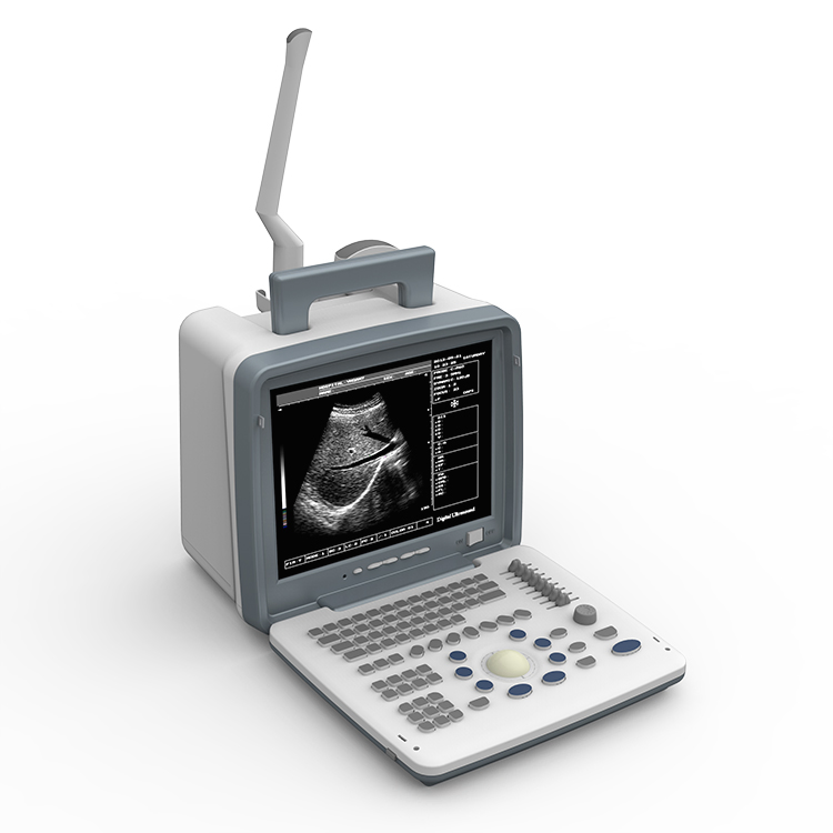 Ubw300 Máquina de ultrasonido portátil humana de bajo precio para instrumentos médicos