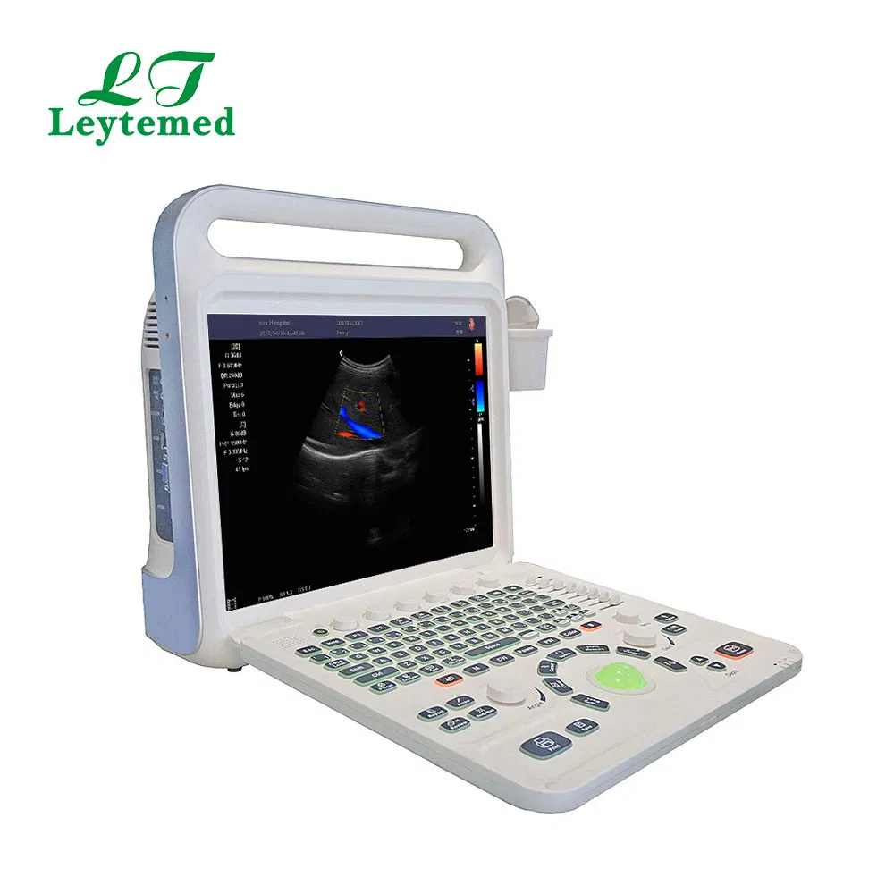 Ltub63 Urología Cardíaca Ginecología Obstetricia USG Doppler Color 4D Máquina de Ultrasonido