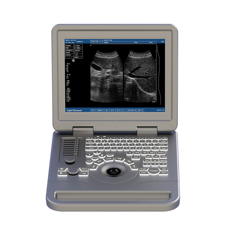 Ubm70A Equipo de Obstetricia Ginecología Verificar Máquina de Ultrasonido Portátil en Blanco y Negro