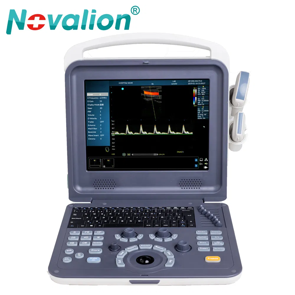 Precio de fábrica al por mayor sistema de diagnóstico ultrasónico Doppler color portátil digital completo