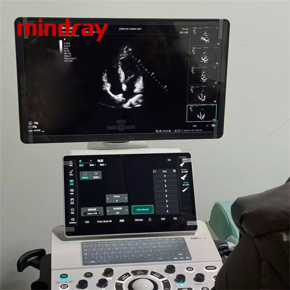 Máquina de Ultrasonido Médico 3D 4D Ultrasonido Tolley Mindray N5 N5s N6 N7 N8 DC26 DC28 Escáner de Ultrasonido Doppler Color Mindray Máquina de Escaneo por Ultrasonido