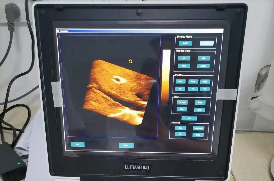 3D 4D Sistema de Ultrasonido Cardíaco Portátil Ecógrafo Color Doppler Laptop