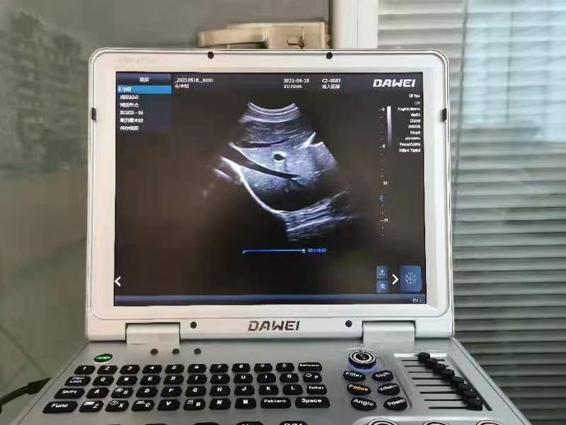 Máquina de ultrasonido portátil 3D/4D/5D Doppler color para obstetricia y ginecología
