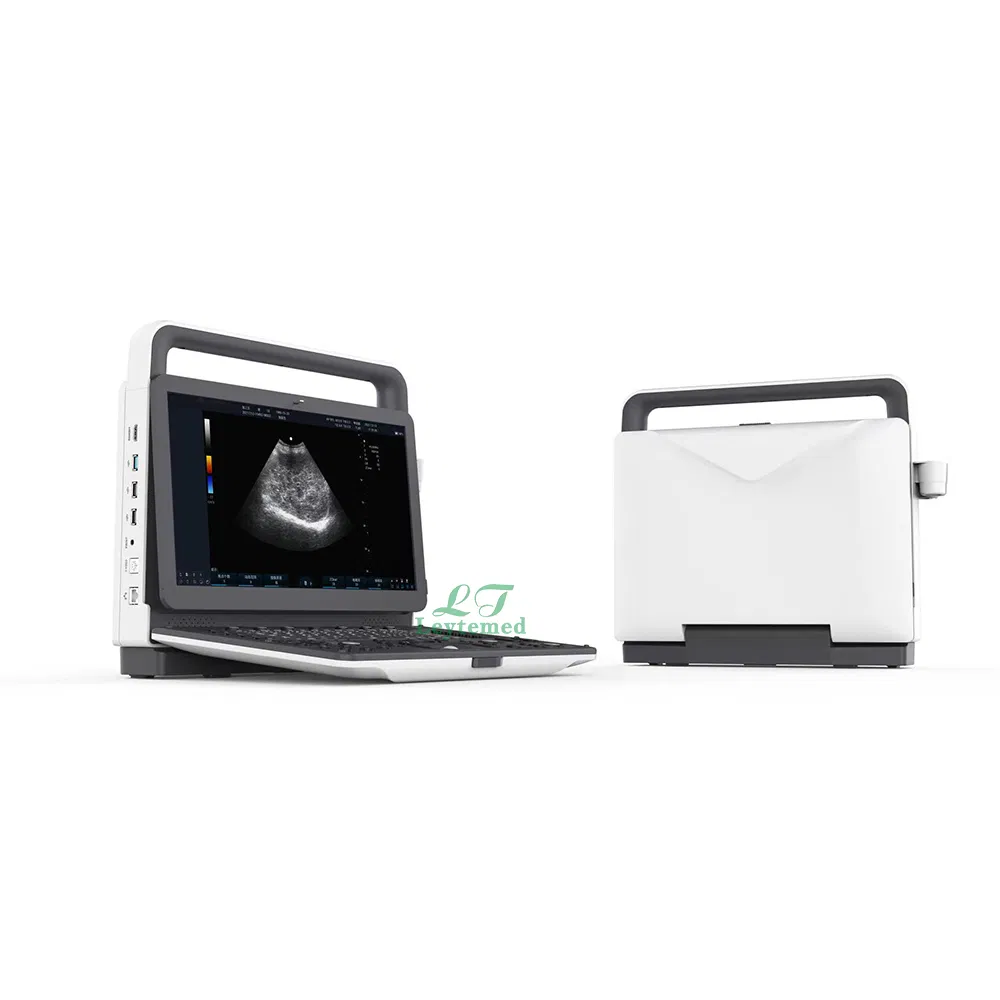 Ltub74 Ciencia Médica 15.6-Inch Sistema de Diagnóstico Ultrasónico Doppler Color Portátil