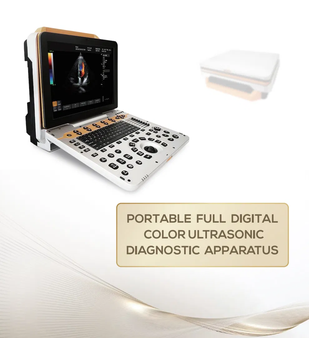 Máquina de ultrasonido diagnóstico portátil Doppler color de alta calidad