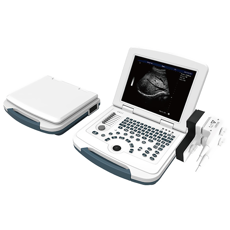 Ubw580 Escáner de diagnóstico digital de embarazo médico portátil de laptop, máquina de ultrasonido humana en blanco y negro