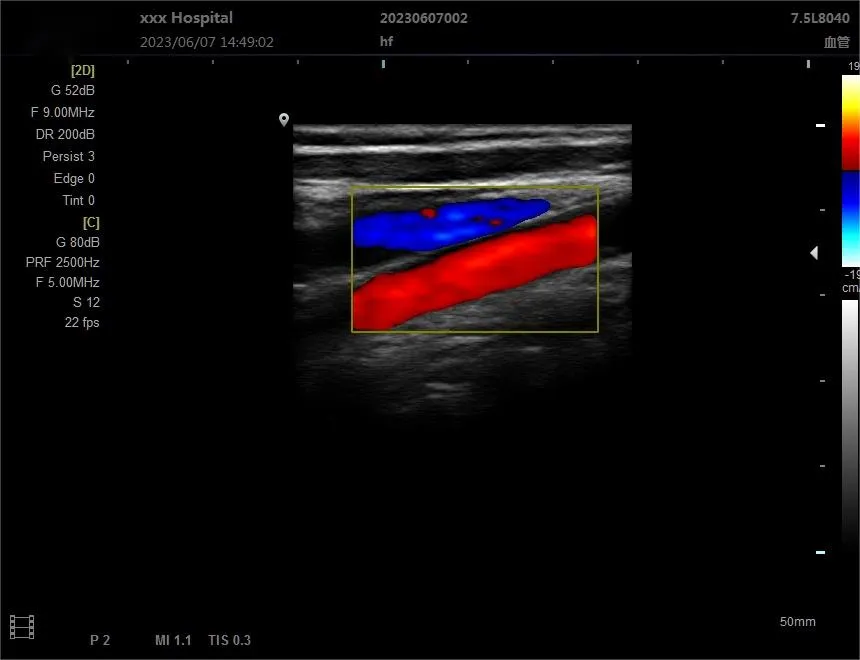 Ultrasonido Doppler 5