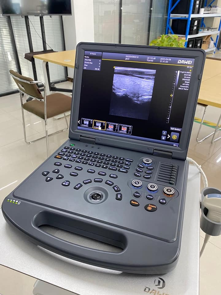 Precio de fábrica Hospital Médico Portátil Laptop 2D 3D 4D Escáner de Ultrasonido Doppler Color Máquina
