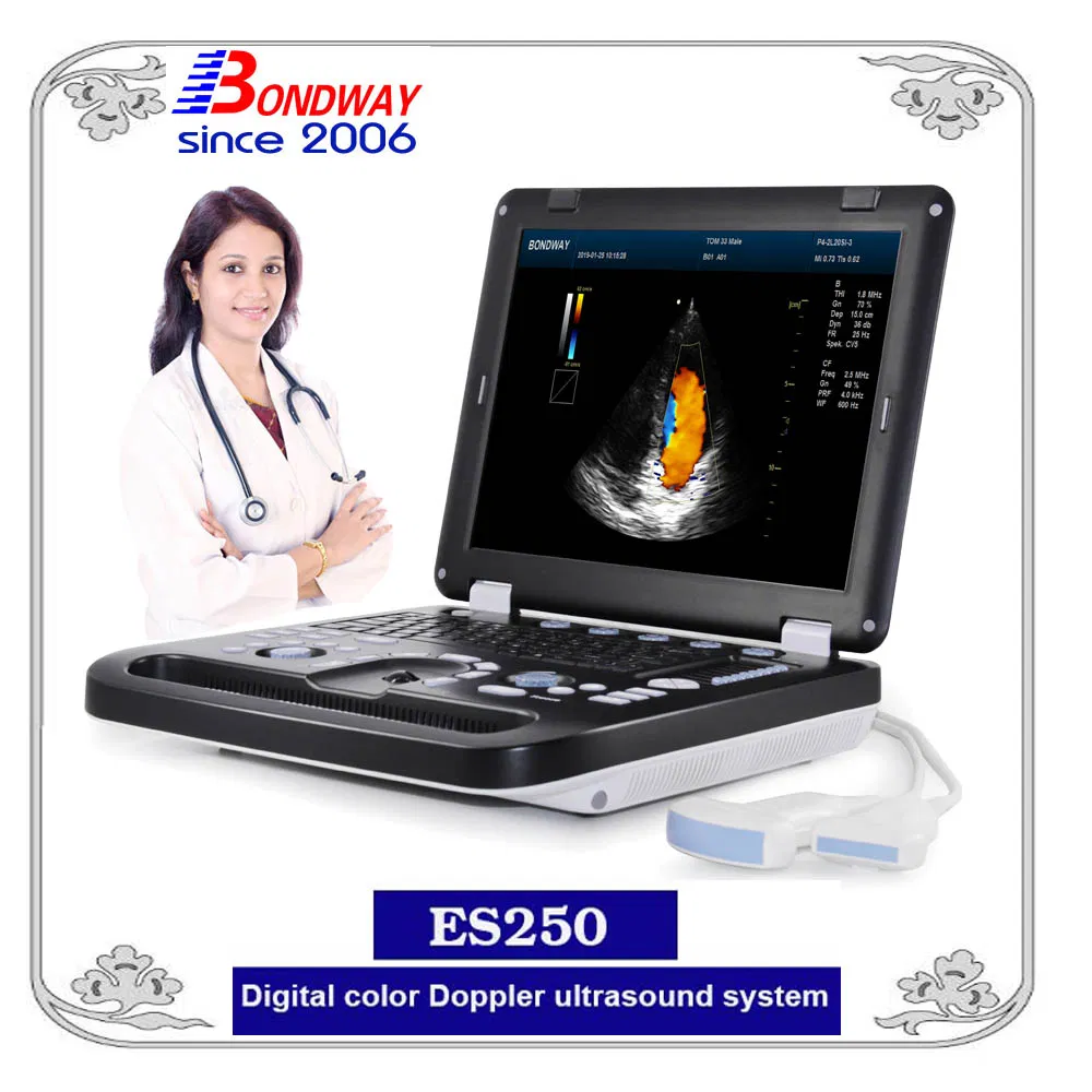 3D/4D Sistema de Imagen Ultrasonido Doppler Color, Sonografía Digital con Pantalla LED Médica Grande