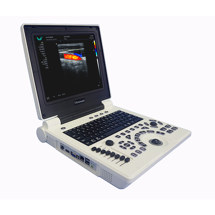 3D Ecografía Abdominal Escaneo Imagen Sonografía Ultrasonografía Sistema