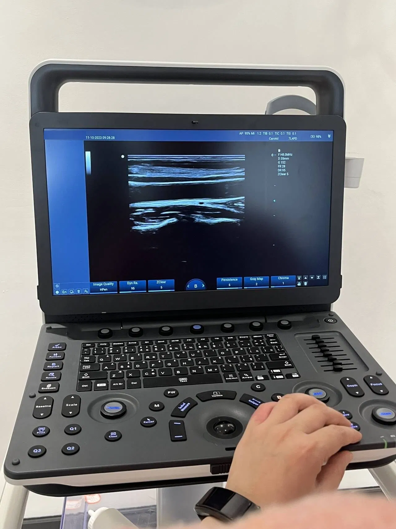 Ltub74 Portátil 15.6-Inch Sistema de Ultrasonido Doppler Color de Alta Resolución 3D 4D