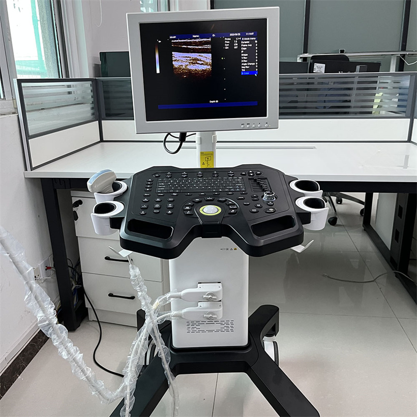 Máquina de diagnóstico ultrasónico digital en blanco y negro de fábrica directa