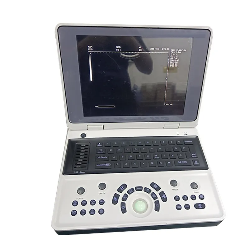YSB3000W Ultrasound 2