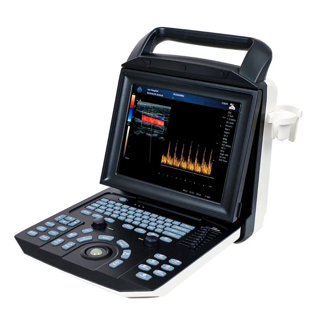 Sistema de ultrasonido cardíaco portátil con ecógrafo color Doppler para laptop