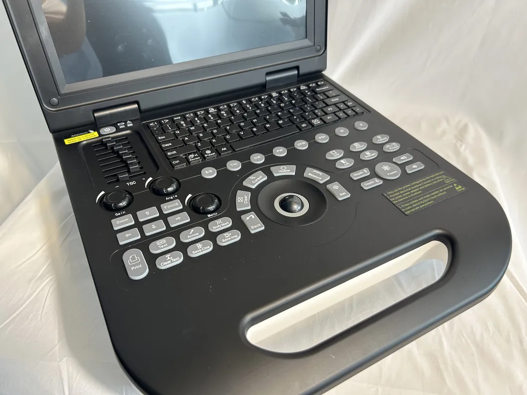 Ultrasonido Doppler 2