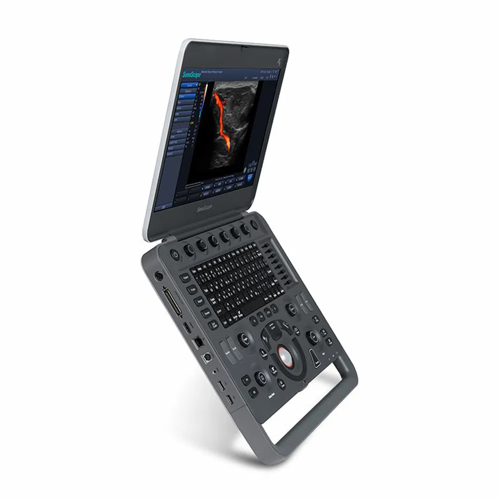 Sistema de Ultrasonido Doppler Color Digital Portátil Sonoscape X5 en Venta Caliente 4D
