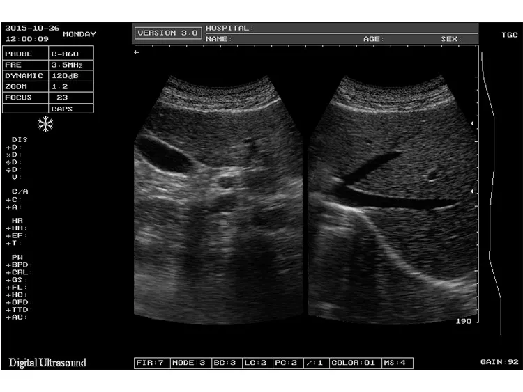Imagen Ultrasonido 2