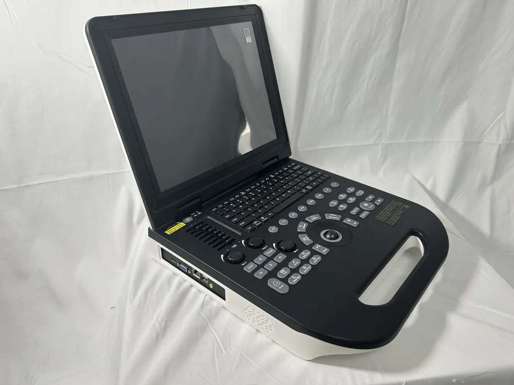 Ultrasonido Doppler 1
