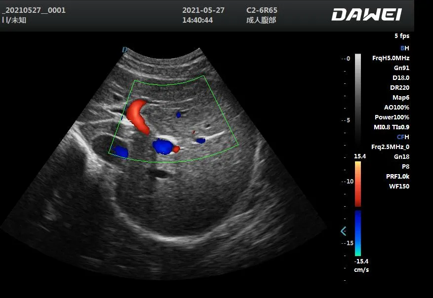 Scan Image 3