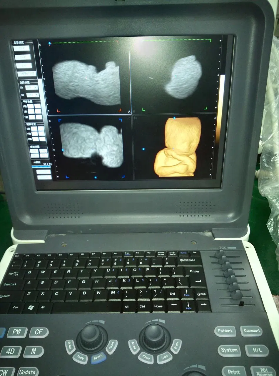 Feto 4D 1