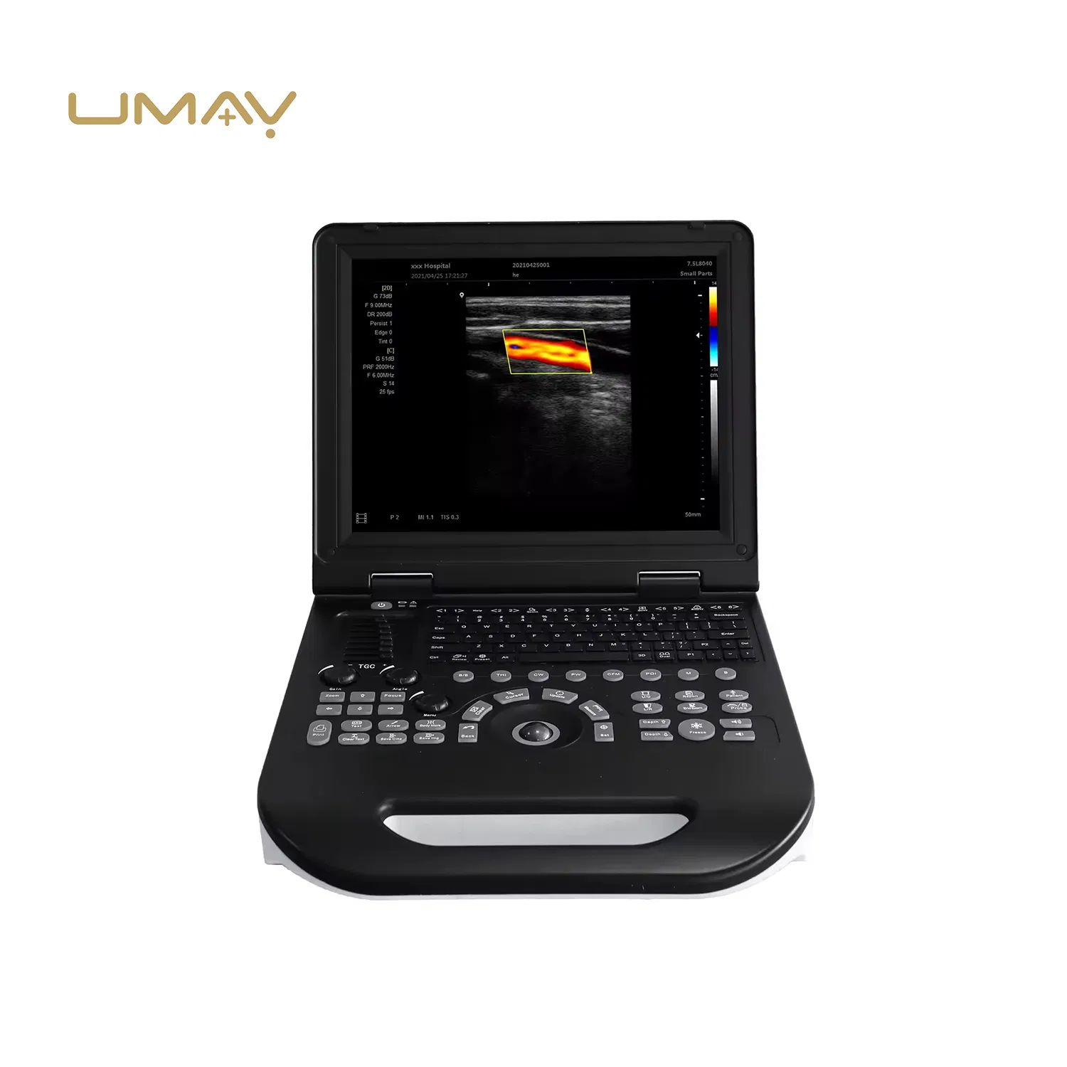 Máquina de Ultrasonido Doppler Color Digital Portátil 3D Completa para Humanos y Veterinaria