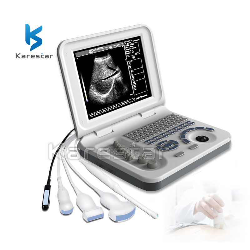 10.4'' Pantalla LED de color Instrumentos de ultrasonido médico portátil en blanco y negro Máquina de ultrasonido usada