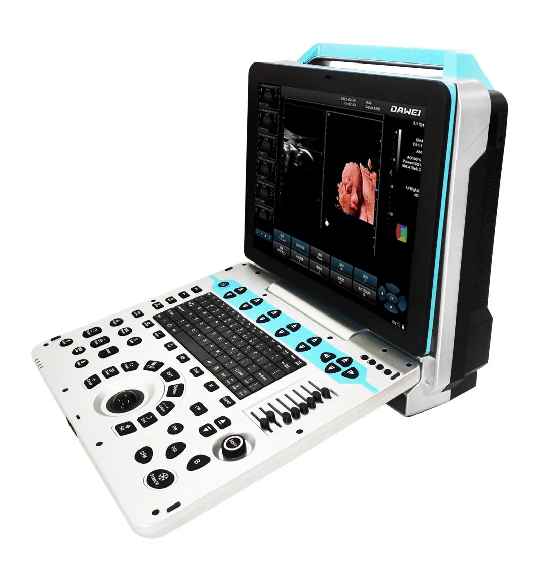 Máquina de ultrasonido Doppler color portátil de obstetricia de fábrica de China con bajo precio 3D/4D/5D
