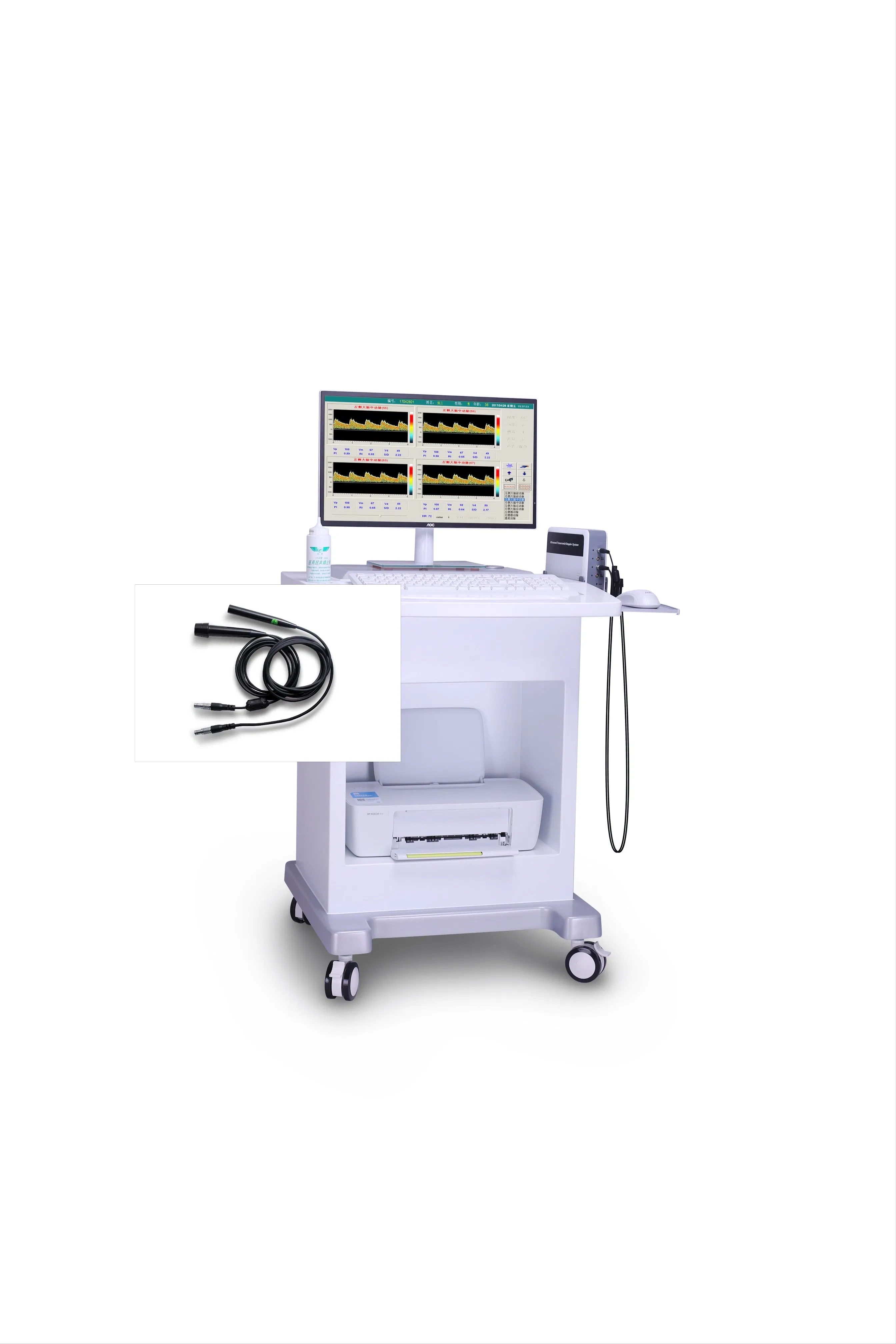 Sistema de ultrasonido Doppler transcraneal Tcd para la detección de vasos intracraneales y del cuello, canal único, cuatro profundidades